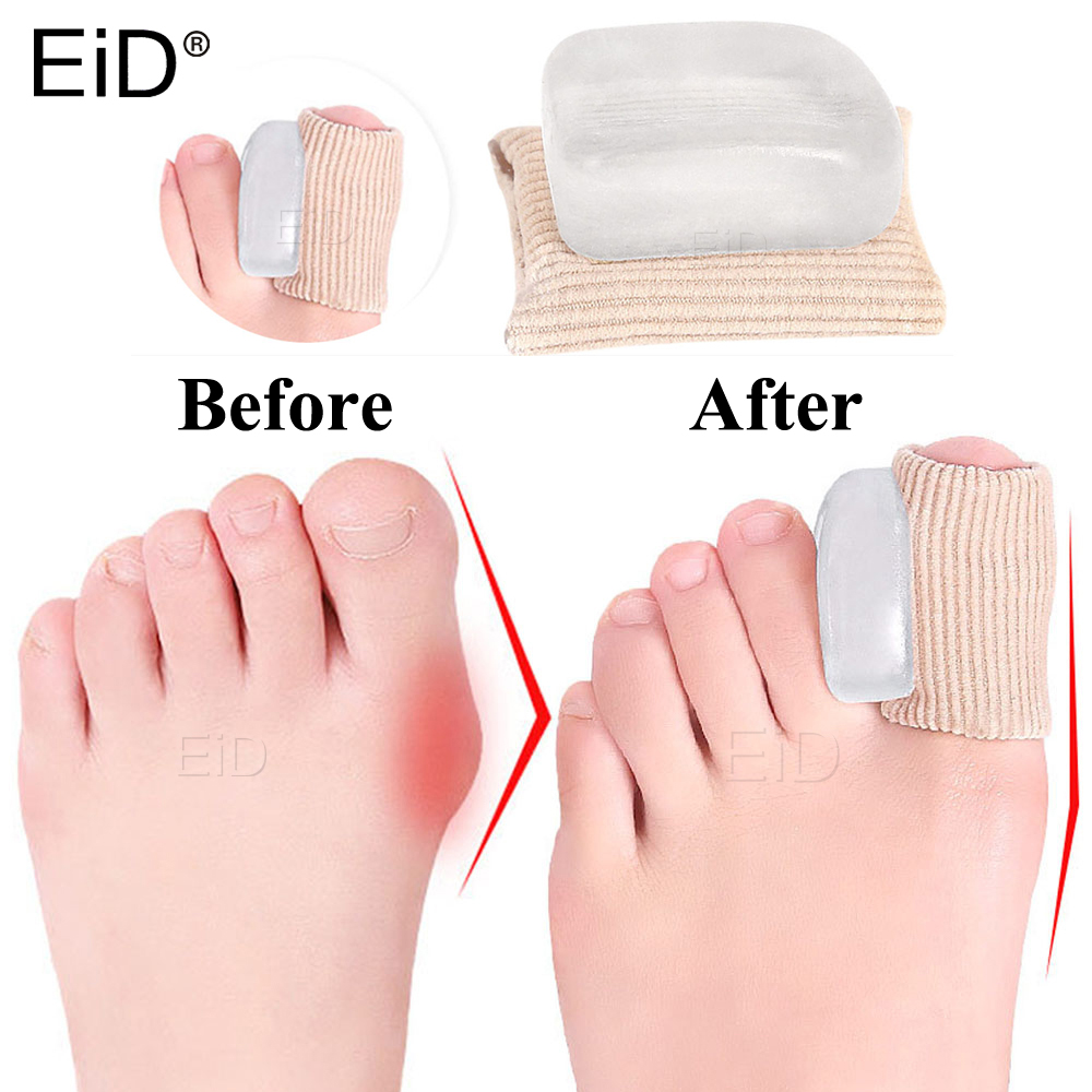 Toe Separator Silicon - 2 шт. силиконовый гель-корректор для большого