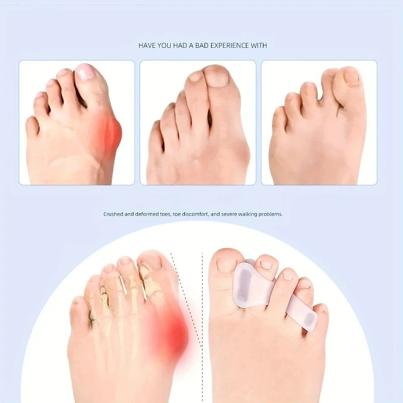 Силиконовые разделители для па – обзор и цена Toe Separator Silicon