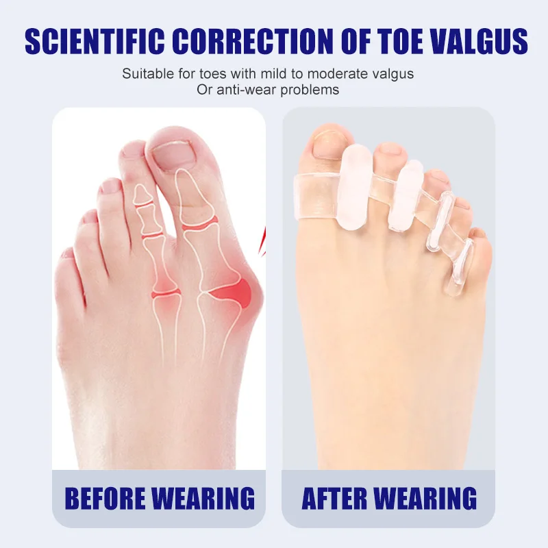 1 пара силиконовых сепараторов – обзор и цена Toe Separator Silicon