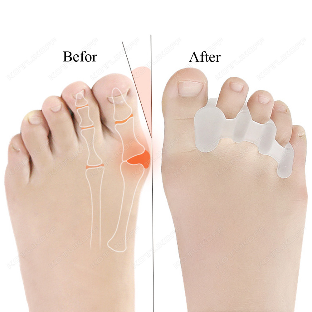 Защитный разделитель пальцев н – обзор и цена Toe Separator Silicon