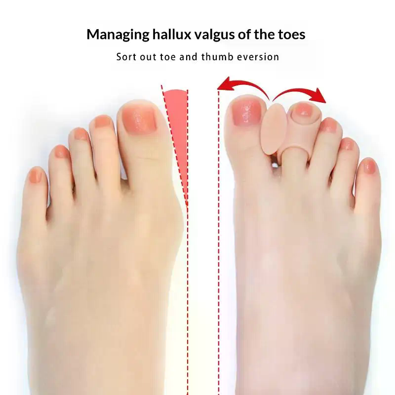 1 пара силиконовых разделителе – обзор и цена Toe Separator Silicon