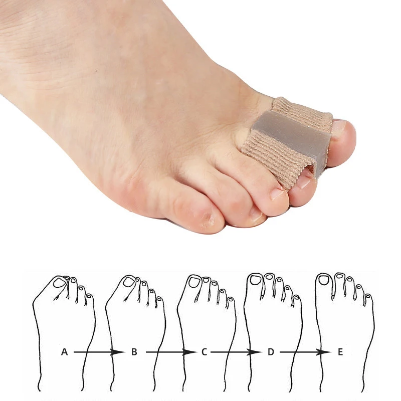 Новый разделитель пальцев ног, – обзор и цена Toe Separator Silicon
