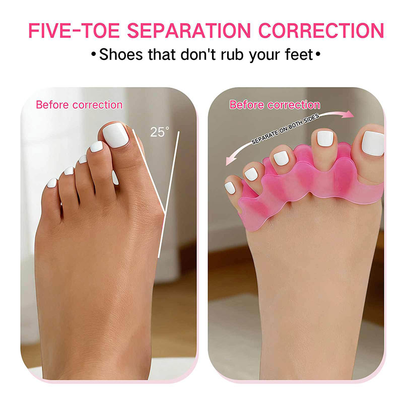 1 пара силиконовых разделителе – обзор и цена Toe Separator Silicon